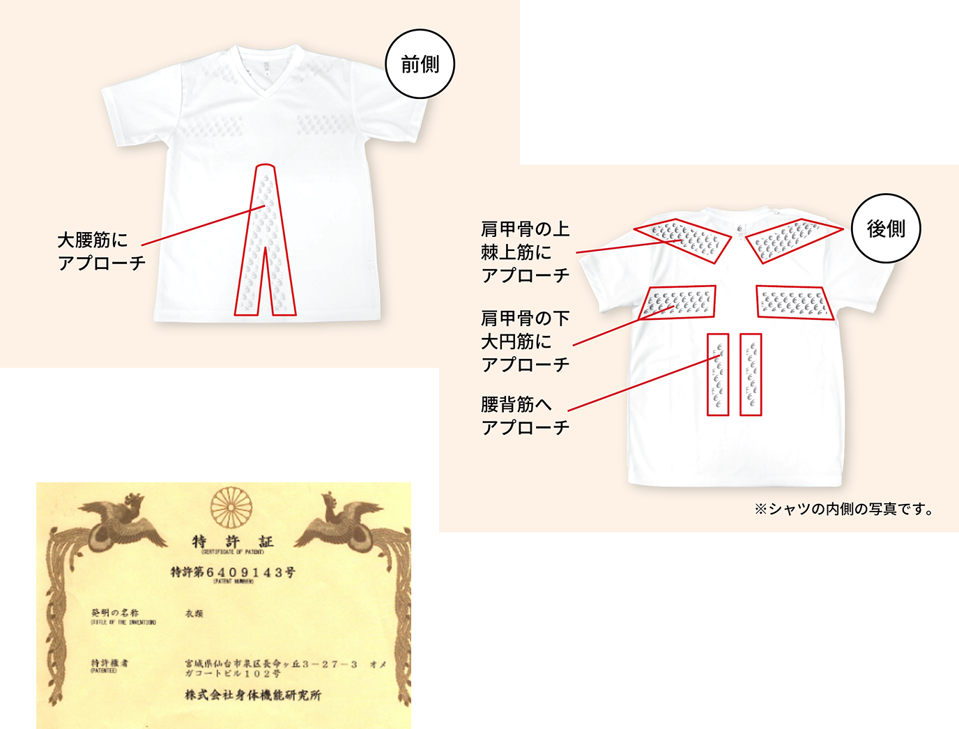 間接テーピング技術